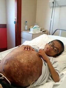 2020 - GIÚP ĐỠ EM CAO TRỰC, ANH DUY, SƯ CÔ THANH TRÚC BỊ BỆNH - รูปภาพจาก Vinimex Group