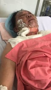 2020 - GIÚP ĐỠ EM CAO TRỰC, ANH DUY, SƯ CÔ THANH TRÚC BỊ BỆNH - รูปภาพจาก Vinimex Group